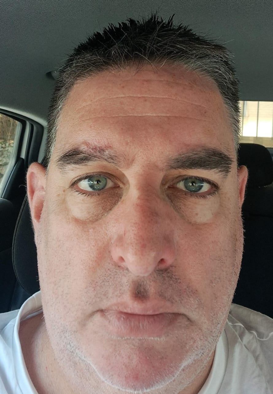 אלמן מישל